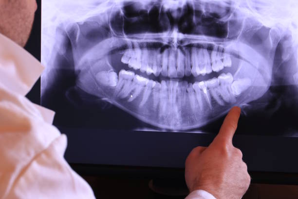 Best Emergency Broken Tooth Repair in Brittany Farms The Highlands, PA