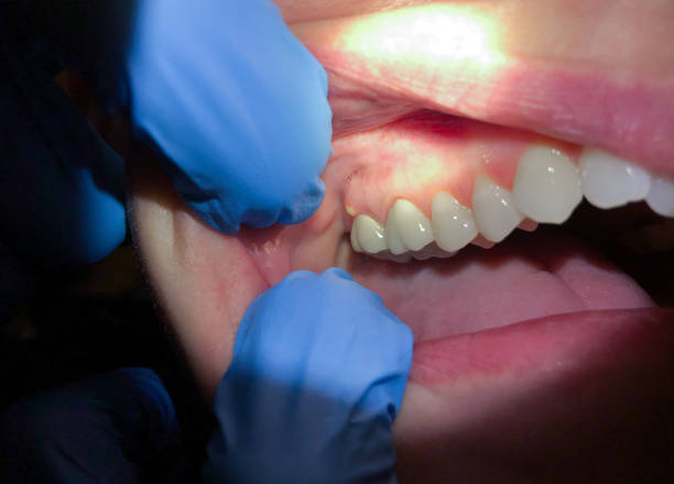 Best Same-Day Emergency Dentist in Brittany Farms The Highlands, PA